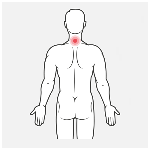 Ergonomie nekklachten